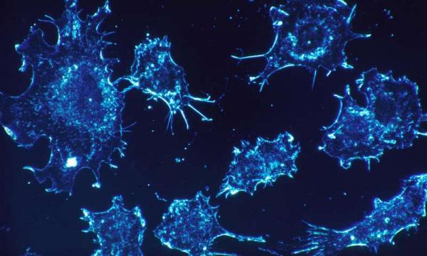 Ген, провоцирующий рак, контролирует воспаление в здоровых тканях - ученые