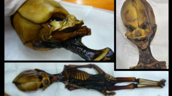 Генетики наконец расшифровали ДНК загадочной мумии "пришельца" из Атакамы
