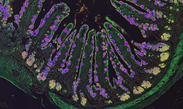 Нервная система тормозит чрезмерное воспаление в организме, выявили ученые