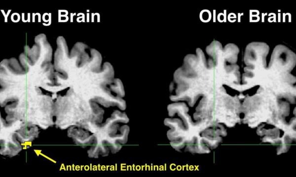 Новые исследования головного мозга дают информацию о потере памяти у пожилых людей