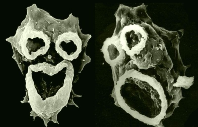 В США появилась опасная амеба, которая пожирает человеческий мозг
