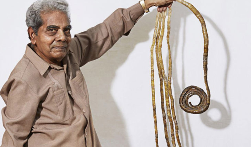 Мужчина из Индии решил подстричь ногти спустя 66 лет