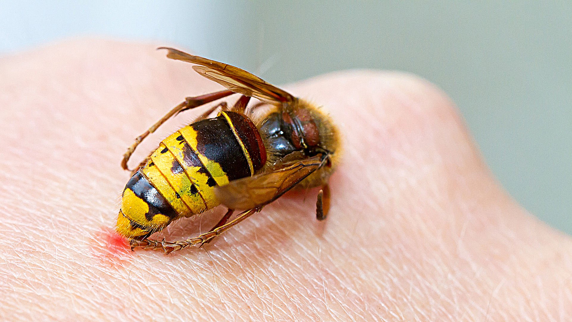 Укусы насекомых: что делать и в каких случаях вызывать скорую помощь