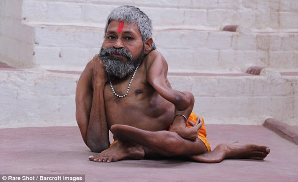 53-летнему индийцу с тяжелым заболеванием костей поклоняются, как божеству