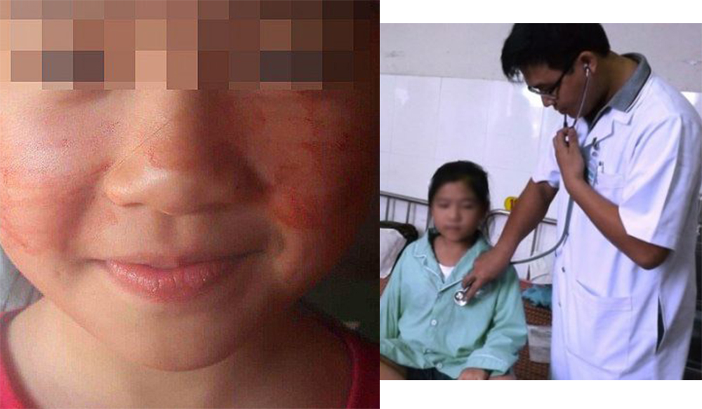 Вьетнамская девочка потеет кровью