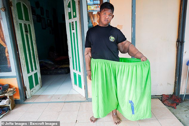 Самый толстый мальчик в мире похудел на 109 кг