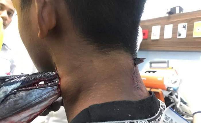 В Индонезии рыба-игла выпрыгнула из воды и проткнула шею парня: фото